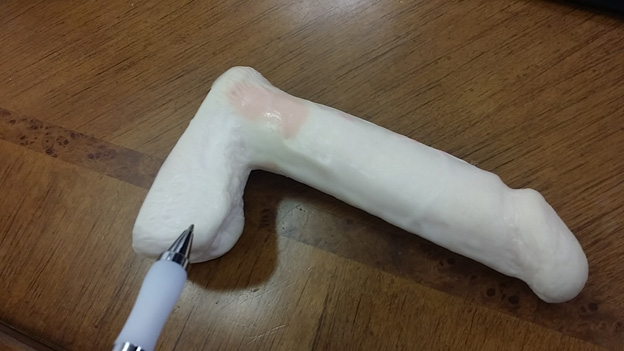 Scrotal-Enhancement